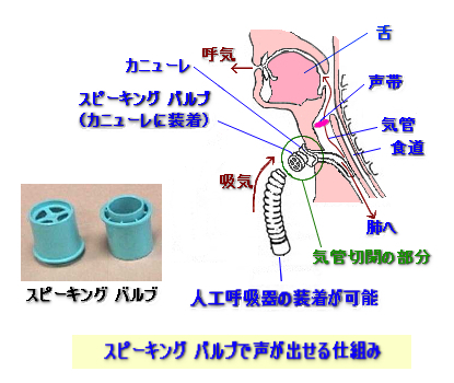 呼吸 仕組み 人工 器 めちゃめちゃ簡単！人工呼吸器の看護①換気モード